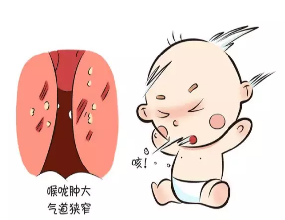 宝宝咳嗽有痰怎么食疗、宝宝咳嗽有痰，食疗调理大法
